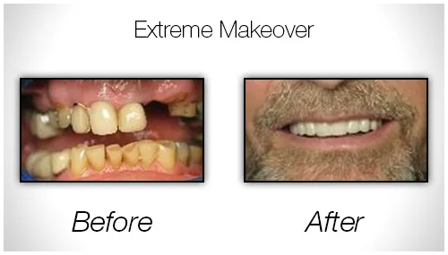 Before And After Photo Showing An Extreme Makeover