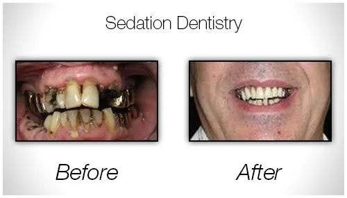 Before And After Photo Showing Repair Of A Severely Damaged Smile