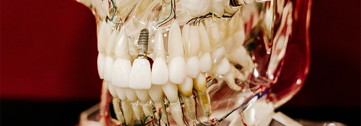 FC – Expert Dental Implant Care at CLINIC NAME* in CITY* STATE*